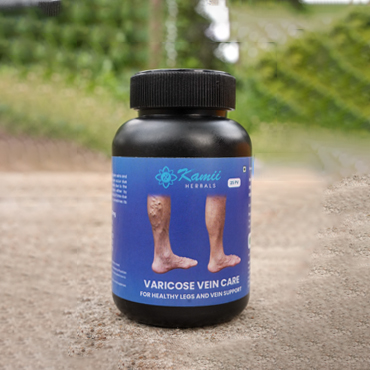 Varicose Vein Care